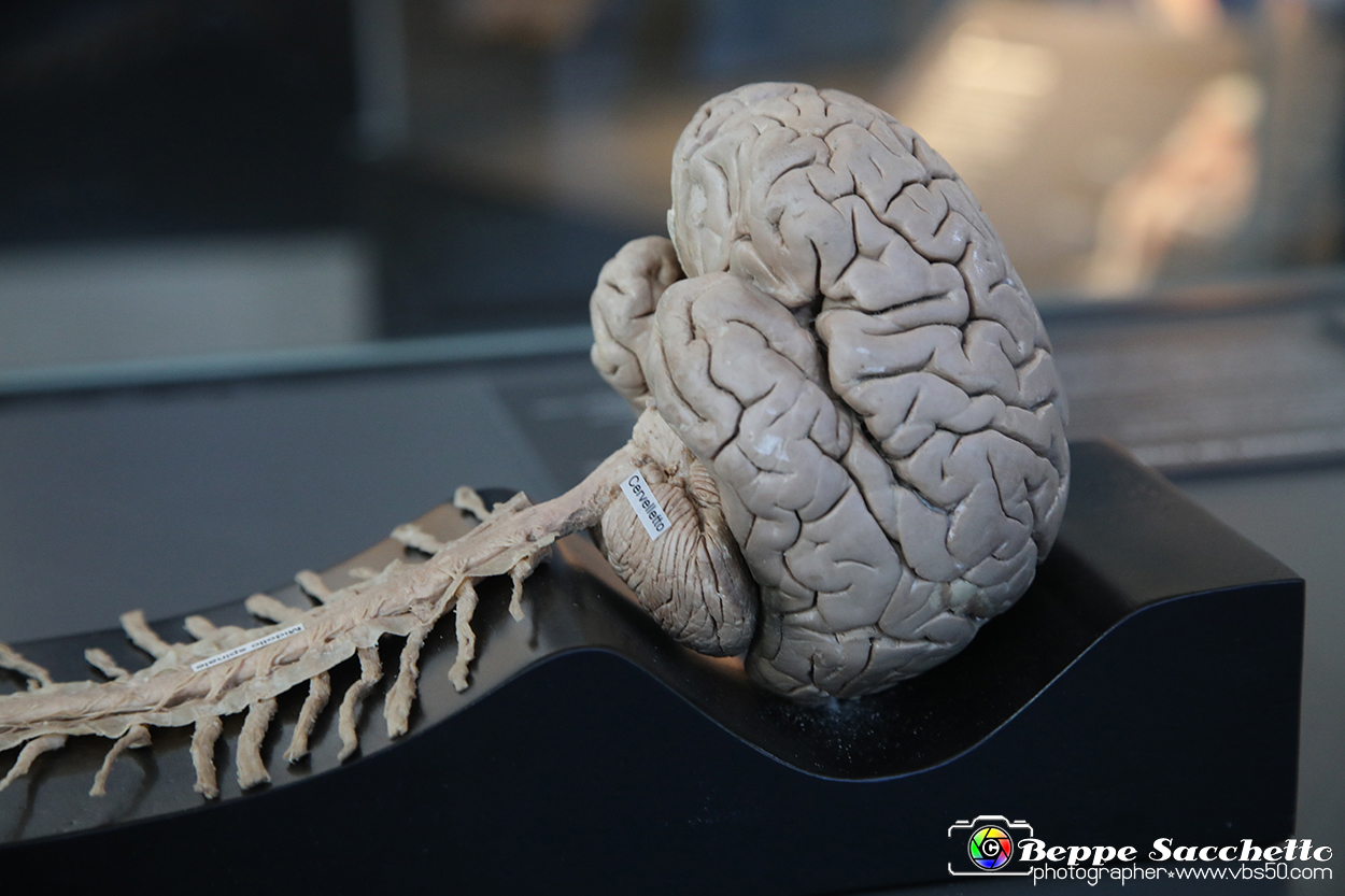 VBS_2979 - Sistema nervoso centrale - Mostra Body Worlds.jpg
